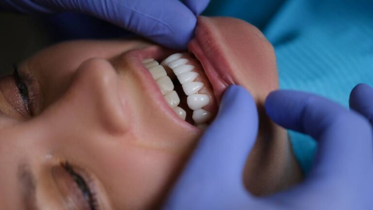 Porcelain Veneers vs Lumineers: Which Is the Best Solution?